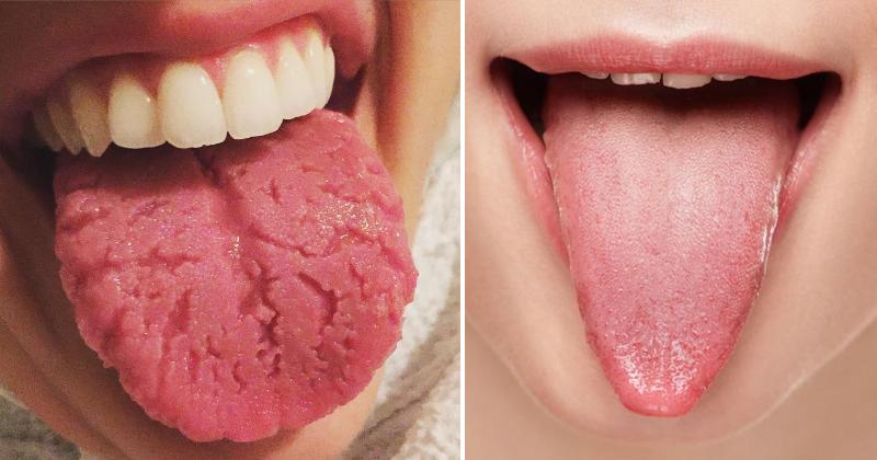 tongue-health-fi