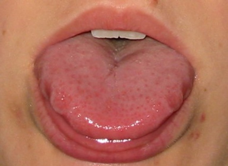 wavy-tongue